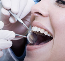 Wygładzanie i czyszczenie korzeni - klinika dentystyczna Froe
